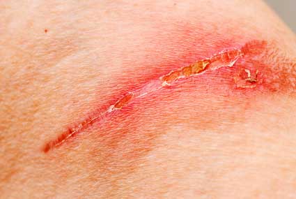 nair hair removal
