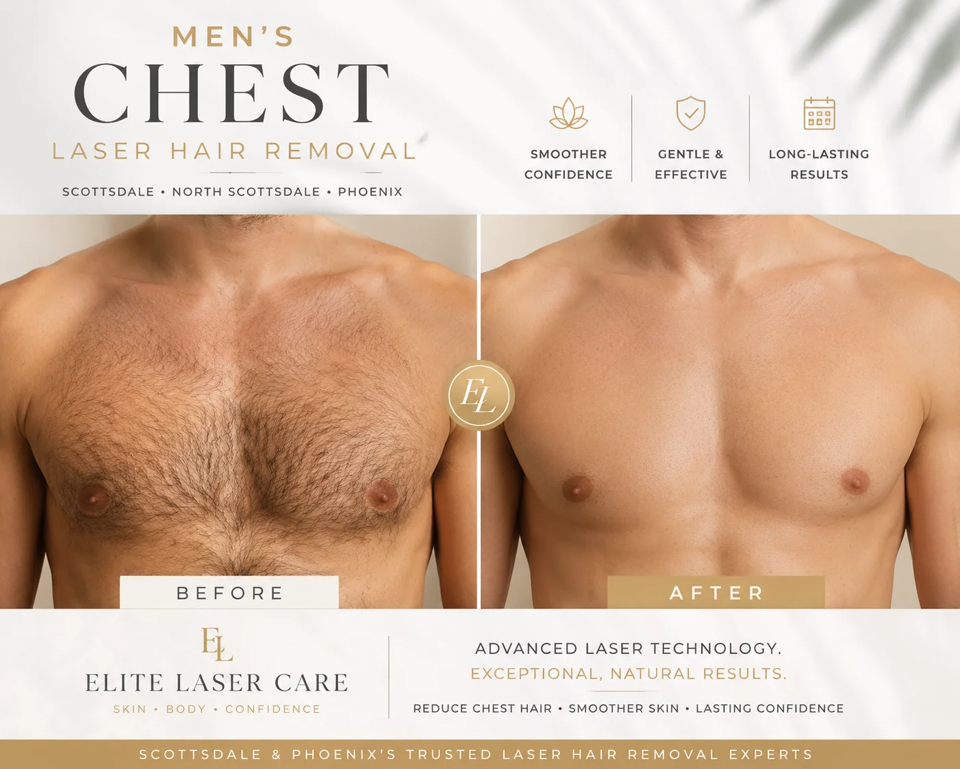 Before and after results of men's chest laser hair removal performed at Elite Laser Care in Scottsdale and Phoenix, Arizona, showing significant long-term hair reduction and smoother chest skin.